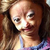 Phi thường - kỳ quặc - Bé gái 6 tuổi thân thể bà già