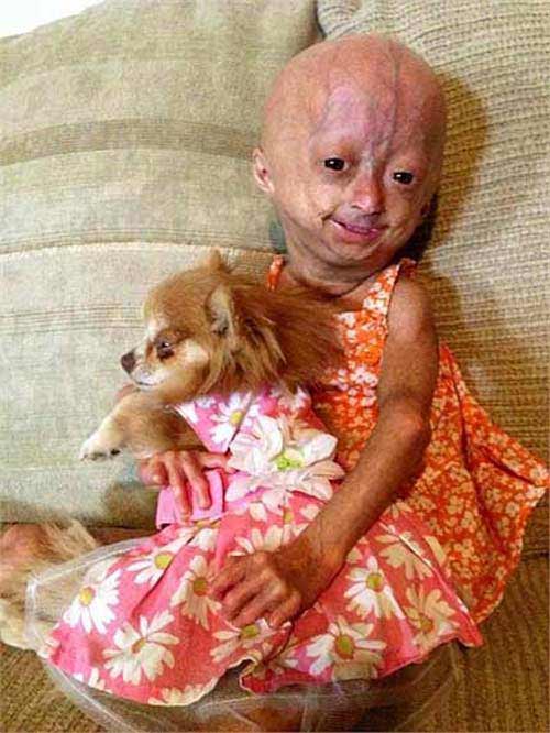 Bé gái 6 tuổi thân thể bà già - 6