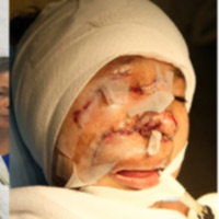 Sức khỏe đời sống - Khuôn mặt mới của "dị nhân” sau bóc tách khối u