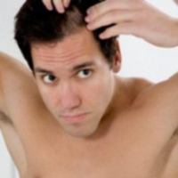 Sức khỏe đời sống - Món ăn bài thuốc chữa chứng tóc bạc sớm