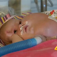 Phi thường - kỳ quặc - Bé gái có khuôn mặt dưa gang