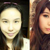 Sức khỏe đời sống - TQ: Bệnh viện quá tải vì... giới trẻ đổ xô "tút tát"