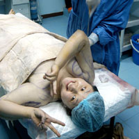 Tin tức trong ngày - Sinh viên TQ đua nhau "cắt gọt" mặt mũi