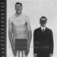 Phi thường - kỳ quặc - Người lùn đột biến thành người khổng lồ