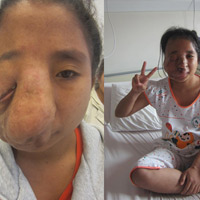 Tin tức trong ngày - Khuôn mặt mới của thiếu nữ "dị nhân"