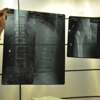 Sức khỏe đời sống - Khi bác sỹ “ăn phim” X- quang