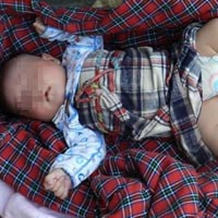 Tin tức trong ngày - TQ: Bé gái sơ sinh 3 chân suýt bị mẹ bỏ rơi