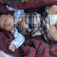 Sức khỏe đời sống - Bé sơ sinh 3 chân bị bỏ rơi