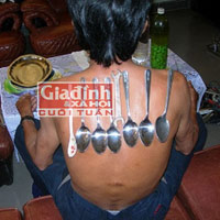 Tin tức trong ngày - Chuyện khó tin về người tự phóng điện