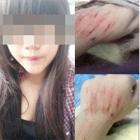 Bạn trẻ - Cuộc sống - Xôn xao cô gái bị tấn công trên đường