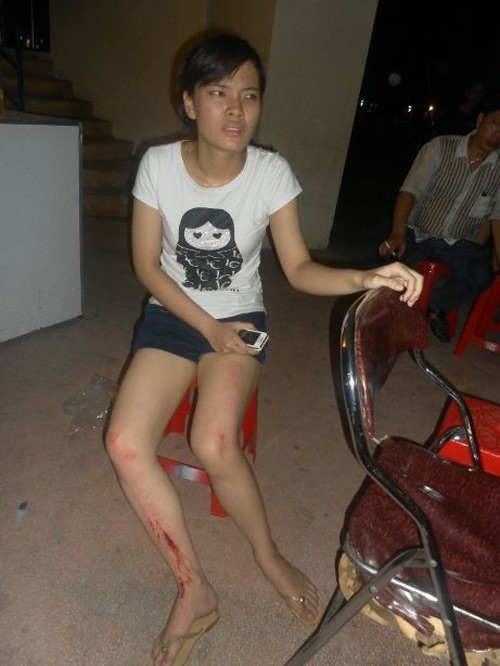 Đoàn xiếc "treo đầu dê" bị vây đánh - 5