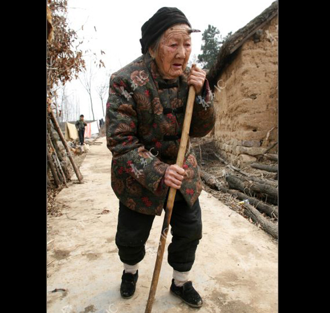 Cụ bà Zhang Ruifang hơn 100 tuổi có một chiếc sừng mọc trên trán trái.
