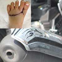 Tin tức trong ngày - Chắn pô "chém" người nhan nhản khắp phố