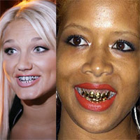 Bí quyết mặc đẹp - Sao xấu đẹp với bộ răng "khoe của"