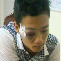 Pháp luật - "Đấu kiếm" ở quán massage, 1 người chết