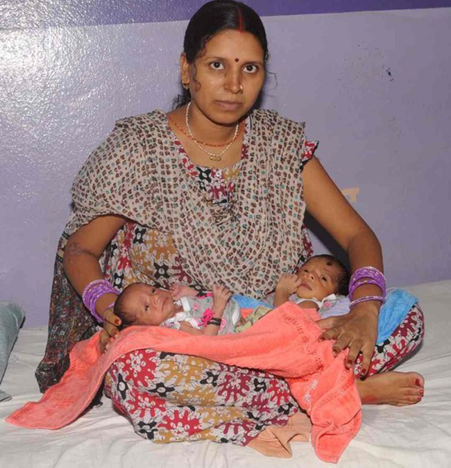 Chị Rinku Devi, 28, người có hai tử cung, sinh đôi hai con cùng lúc