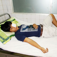 Giáo dục - du học - Thầy giáo đánh rách mắt học sinh