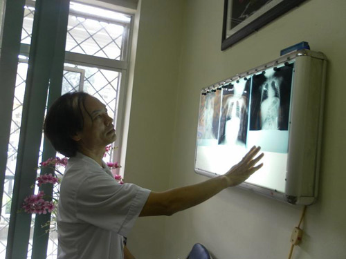 Nguy cơ tử vong vì hóc, sặc thức ăn - 2