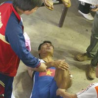 Thể thao - Dính chấn thương là gay go