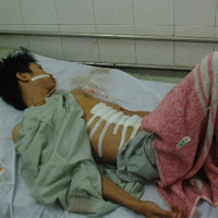 Pháp luật - Bị dập lá lách sau khi làm việc với CA