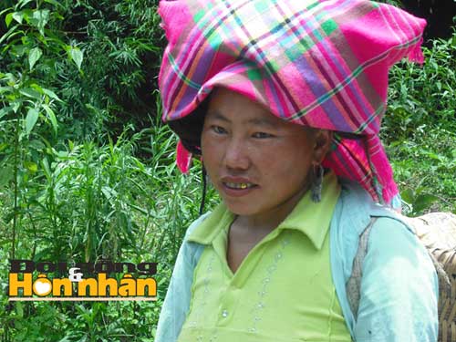 Bi hài nơi phụ nữ tuổi cập kê là rụng răng - 2