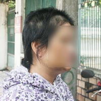 Pháp luật - Một phụ nữ bị con tình nhân đánh bầm dập