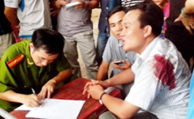 Chuyển công tác CSGT bắn 2 người vi phạm GT - 2