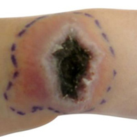 Sức khỏe đời sống - Nhiễm virus đậu mùa sau khi giải cứu mèo