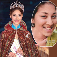 Làm đẹp - Tân hoa hậu Hong Kong từng chỉnh răng