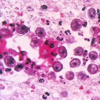 Tin tức trong ngày - Mỹ: Nước máy nhiễm amip ăn não người