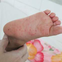 Sức khỏe đời sống - HN: Yêu cầu ứng phó với dịch bệnh bùng phát