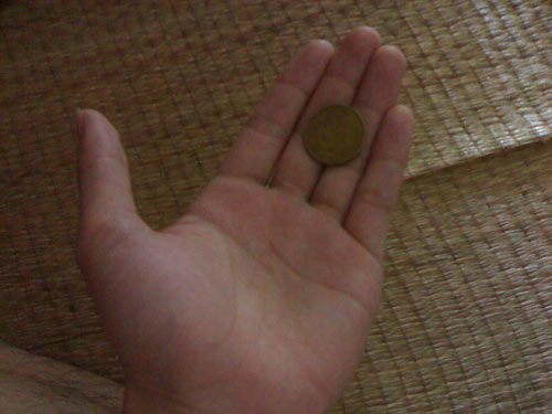 Đồng xu mắc trong thực quản bé trai 1 năm - 1