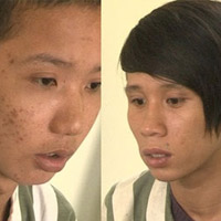 Pháp luật - Bắt nhóm chuyên cướp của người tập thể dục