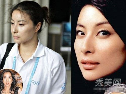 "Gót chân Asin" trên gương mặt sao (P1) - 1