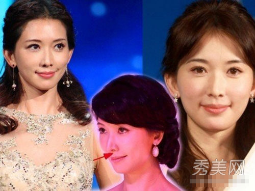 "Gót chân Asin" trên gương mặt sao (P1) - 2