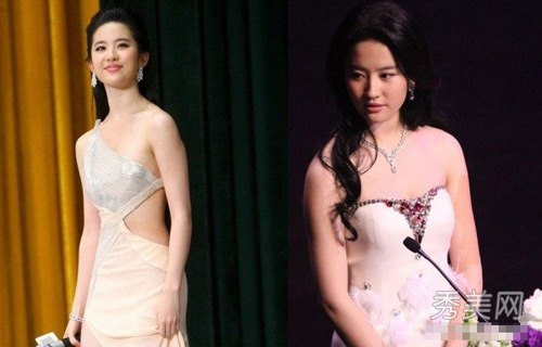 "Gót chân Asin" trên gương mặt sao (P1) - 4