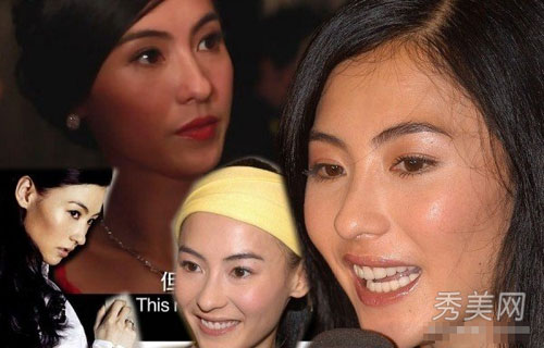 "Gót chân Asin" trên gương mặt sao (P1) - 6