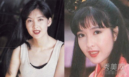 "Gót chân Asin" trên gương mặt sao (P1) - 7