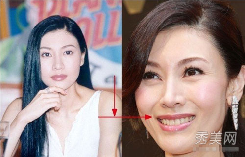 "Gót chân Asin" trên gương mặt sao (P1) - 9