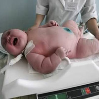 Phi thường - kỳ quặc - Những em bé sơ sinh "su mô"