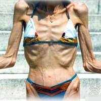 Bí quyết làm đẹp - Rùng mình với thân hình gày trơ xương