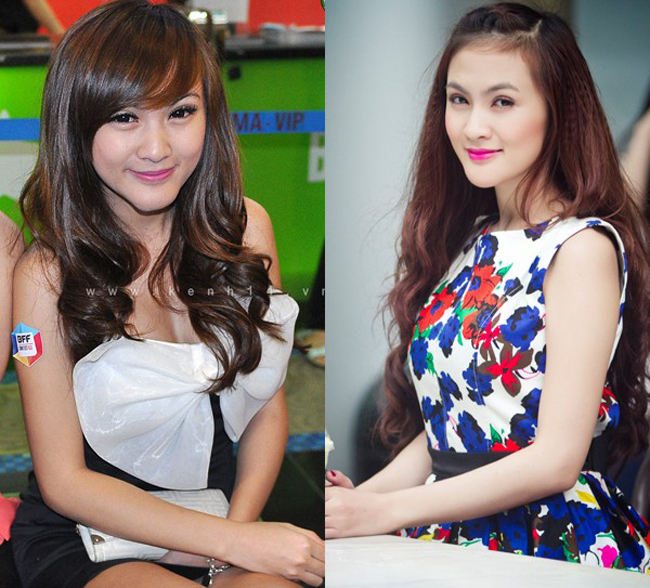 Hotgirl Kelly Nguyễn thừa nhận phải trải qua 5 lần phẫu thuật thẩm mỹ cằm và suýt bị hoại tử.
