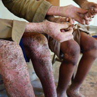 Tin tức trong ngày - Kỳ lạ: Hai cha con "người rắn" ở Quảng Nam