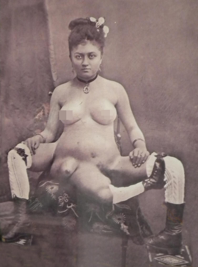 Blanche Dumas sinh năm 1860 tại hòn đảo Martinique, một trong hàng chục vùng đất thuộc Pháp ở Caribbean. Cô được xếp vào danh sách những gái bán dâm được trả thù lao rất cao ở Paris, nhờ có 3 chân, hai âm đạo. 
