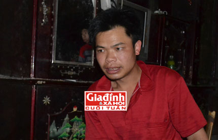 Đau lòng những đứa trẻ mang hình hài của… khỉ - 2