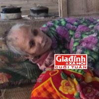 Sức khỏe đời sống - Căn bệnh kỳ lạ của người đàn bà bị gán tiếng “ma rừng”