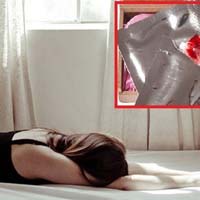 Sức khỏe đời sống - Tự vá màng trinh, tân nương gây họa với cái "của nợ"
