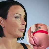 Bí quyết làm đẹp - Tâm sự của người nổi tiếng nhờ cặp mông biến dạng