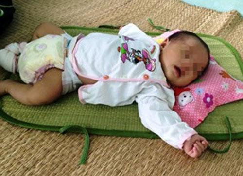 Bé trai 36 ngày bị biến chứng hôn mê do tiểu đường sơ sinh - 1