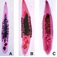 Sức khỏe đời sống - Ăn gỏi cá bị sán lá gan làm tổ trong 'của quý'